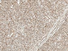 WNT4 Antibody - Immunohistochemistry analysis using Rabbit Anti-Wnt4 Polyclonal Antibody. Tissue: Kidney. Species: Human. Fixation: Formalin Fixed Paraffin-Embedded. Primary Antibody: Rabbit Anti-Wnt4 Polyclonal Antibody  at 1:50 for 30 min at RT. Counterstain: Hematoxylin. Magnification: 10X. HRP-DAB Detection.