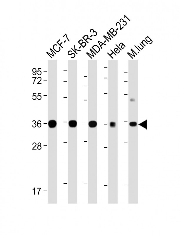 WNT4 Antibody - All lanes: Anti-WNT4 Antibody at 1:4000 dilution Lane 1: MCF-7 whole cell lysate Lane 2: SK-BR-3 whole cell lysate Lane 3: MDA-MB-231 whole cell lysate Lane 4: Hela whole cell lysate Lane 5: Mouse lung lysate Lysates/proteins at 20 µg per lane. Secondary Goat Anti-mouse IgG, (H+L), Peroxidase conjugated at 1/10000 dilution. Predicted band size: 39 kDa Blocking/Dilution buffer: 5% NFDM/TBST.
