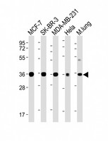 WNT4 Antibody - All lanes: Anti-WNT4 Antibody at 1:4000 dilution Lane 1: MCF-7 whole cell lysate Lane 2: SK-BR-3 whole cell lysate Lane 3: MDA-MB-231 whole cell lysate Lane 4: Hela whole cell lysate Lane 5: Mouse lung lysate Lysates/proteins at 20 µg per lane. Secondary Goat Anti-mouse IgG, (H+L), Peroxidase conjugated at 1/10000 dilution. Predicted band size: 39 kDa Blocking/Dilution buffer: 5% NFDM/TBST.