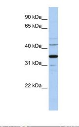 WNT5A Antibody - Hela cell lysate. Antibody concentration: 1.0 ug/ml. Gel concentration: 12%.  This image was taken for the unconjugated form of this product. Other forms have not been tested.