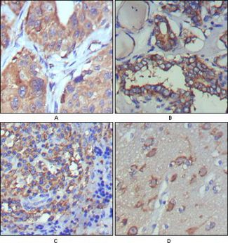 WNT5A Antibody - WNT5A Antibody in Immunohistochemistry (IHC)