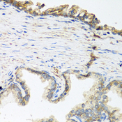 WNT5A Antibody - Immunohistochemistry of paraffin-embedded human prostate.