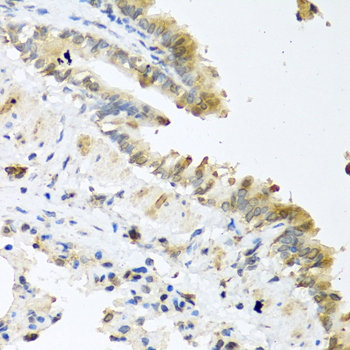 WNT5A Antibody - Immunohistochemistry of paraffin-embedded mouse lung tissue.