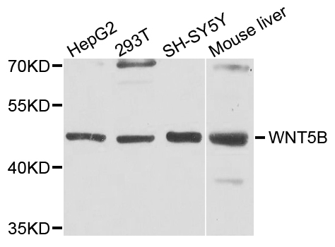 WNT5B Antibody - Western blot analysis of extract of various cells.