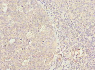WNT5B Antibody - Immunohistochemistry of paraffin-embedded human tonsil tissue at dilution 1:100