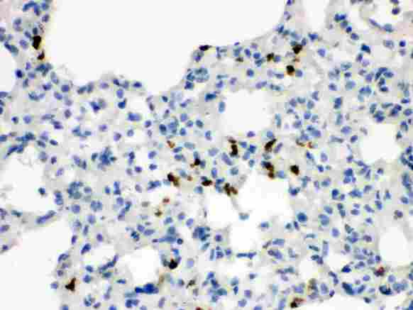 WNT7A Antibody - anti-Wnt7a antibody, IHC(P): Rat Lung Tissue