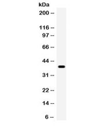 WNT7A Antibody - Western blot testing of human HeLa cell lysate with WNT7A antibody. Expected/observed molecular weight ~39 kDa.