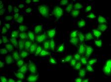 WNT7A Antibody - Immunofluorescence analysis of A549 cells using WNT7A Polyclonal Antibody.