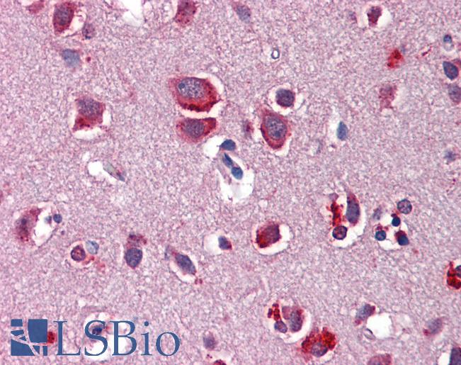 WNT7B Antibody - Anti-WNT7B antibody IHC of human brain, cortex. Immunohistochemistry of formalin-fixed, paraffin-embedded tissue after heat-induced antigen retrieval. Antibody concentration 5 ug/ml.  This image was taken for the unconjugated form of this product. Other forms have not been tested.