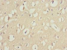 WNT7B Antibody - Immunohistochemistry of paraffin-embedded human brain tissue at dilution 1:100