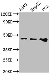 WNT7B Antibody - Western Blot Positive WB detected in: A549 whole cell lysate, HepG2 whole cell lysate, PC-3 whole cell lysate All lanes: WNT7B antibody at 2.4µg/ml Secondary Goat polyclonal to rabbit IgG at 1/50000 dilution Predicted band size: 40 kDa Observed band size: 47 kDa