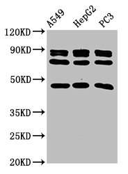 WNT7B Antibody - Western Blot Positive WB detected in: A549 whole cell lysate, HepG2 whole cell lysate, PC-3 whole cell lysate All lanes: WNT7B antibody at 2.2µg/ml Secondary Goat polyclonal to rabbit IgG at 1/50000 dilution Predicted band size: 40 kDa Observed band size: 47 kDa