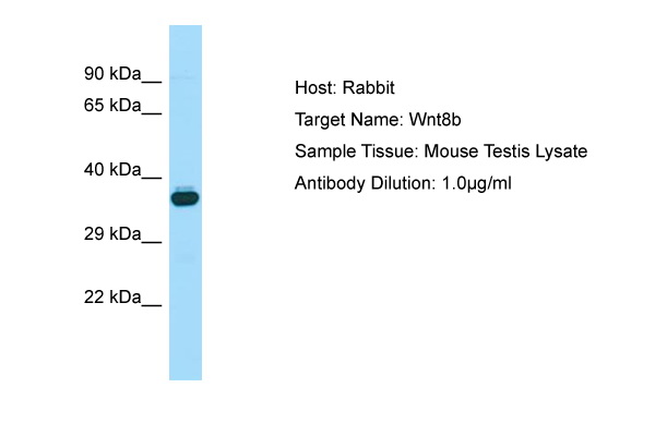WNT8B / Wnt 8b Antibody -  This image was taken for the unconjugated form of this product. Other forms have not been tested.