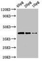 WNT8B / Wnt 8b Antibody - Western Blot Positive WB detected in:Zebrafish tissue 40 ug, 20 ug, 10 ug All Lanes:wnt8b antibody at 3µg/ml Secondary Goat polyclonal to rabbit IgG at 1/50000 dilution Predicted band size: 41 KDa Observed band size: 41 KDa