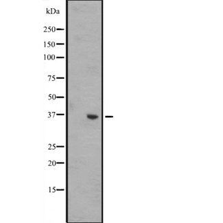 WNT8B / Wnt 8b Antibody - Western blot analysis of WNT8B expression in A431 whole cells lysate. The lane on the left is treated with the antigen-specific peptide.