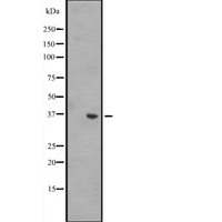 WNT8B / Wnt 8b Antibody - Western blot analysis of WNT8B expression in A431 whole cells lysate. The lane on the left is treated with the antigen-specific peptide.