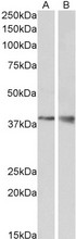 WNT9B / WNT15 Antibody - Goat Anti-WNT15 / WNT9B Antibody (1µg/ml) staining of Mouse Kidney (A) and Brain (B) lysate (35µg protein in RIPA buffer). Primary incubation was 1 hour. Detected by chemiluminescencence.
