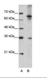 WNT9B / WNT15 Antibody - A: Marker, B: Jurkat Cell Lysate.  This image was taken for the unconjugated form of this product. Other forms have not been tested.