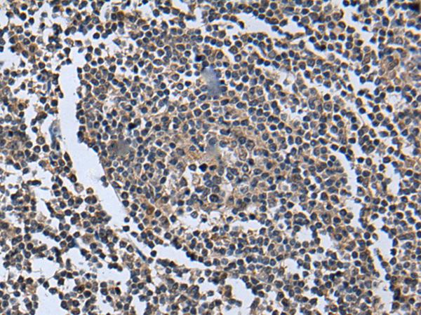 WNT9B / WNT15 Antibody - Immunohistochemistry of paraffin-embedded Human tonsil tissue  using WNT9B Polyclonal Antibody at dilution of 1:85(×200)