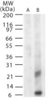 WNV GpM Antibody - Western blot of West Nile Virus glycoprotein M in (A) untransfected and (B) transfected mouse melanoma cells using antibody at 1 ug/ml.