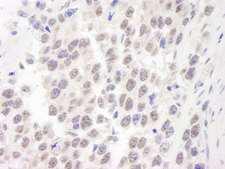 WRN Antibody - Detection of Human WRN by Immunohistochemistry. Sample: FFPE section of human seminoma. Antibody: Affinity purified rabbit anti-WRN used at a dilution of 1:250.