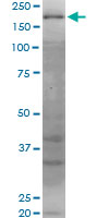 WRN Antibody - WRN monoclonal antibody (M06), clone 2F7. Western Blot analysis of WRN expression in Jurkat.