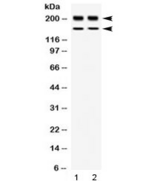 WRN Antibody - Western blot testing of 1) rat thymus and 2) human placenta lysate with WRN antibody at 0.5ug/ml. Observed molecular weight: ~162 and 200 kDa.