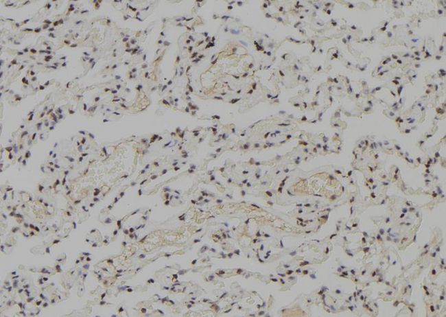 WRN Antibody - 1:100 staining human lung tissue by IHC-P. The sample was formaldehyde fixed and a heat mediated antigen retrieval step in citrate buffer was performed. The sample was then blocked and incubated with the antibody for 1.5 hours at 22°C. An HRP conjugated goat anti-rabbit antibody was used as the secondary.