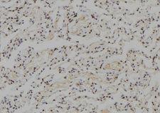 WRN Antibody - 1:100 staining human lung tissue by IHC-P. The sample was formaldehyde fixed and a heat mediated antigen retrieval step in citrate buffer was performed. The sample was then blocked and incubated with the antibody for 1.5 hours at 22°C. An HRP conjugated goat anti-rabbit antibody was used as the secondary.