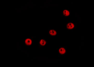 WRN Antibody - Staining HeLa cells by IF/ICC. The samples were fixed with PFA and permeabilized in 0.1% Triton X-100, then blocked in 10% serum for 45 min at 25°C. The primary antibody was diluted at 1:200 and incubated with the sample for 1 hour at 37°C. An Alexa Fluor 594 conjugated goat anti-rabbit IgG (H+L) antibody, diluted at 1/600, was used as secondary antibody.