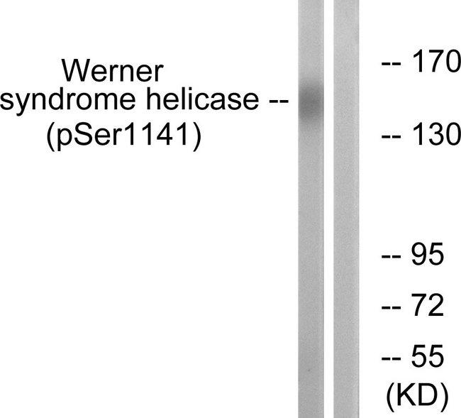 WRN Antibody - Western blot analysis of extracts from K562 cells, treated with etoposide (25uM, 24hours), using Werner Syndrome Helicase (Phospho-Ser1141) antibody.