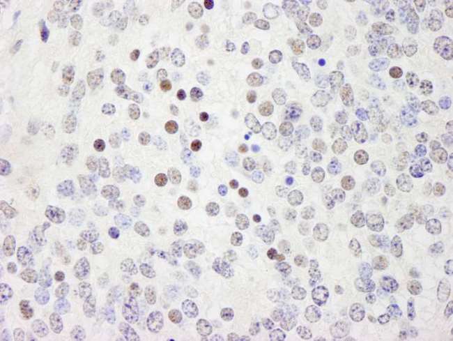 WRNIP1 / WHIP Antibody - Detection of Mouse WRNIP1 by Immunohistochemistry. Sample: FFPE section of mouse teratoma. Antibody: Affinity purified rabbit anti-WRNIP1 used at a dilution of 1:250.