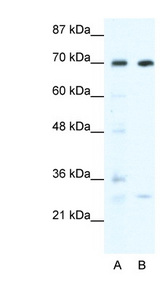 WRNIP1 / WHIP Antibody - WRNIP1 / WHIP antibody Western blot of HepG2 cell lysate. This image was taken for the unconjugated form of this product. Other forms have not been tested.