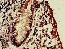 WSB1 Antibody - Immunohistochemistry image of paraffin-embedded human appendix tissue at a dilution of 1:100