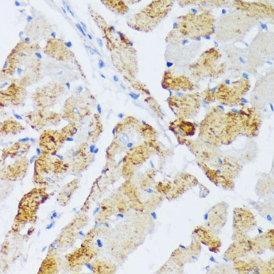 WSB2 Antibody - Immunohistochemistry of paraffin-embedded Rat heart using WSB2 Polyclonal Antibody at dilution of 1:100 (40x lens).