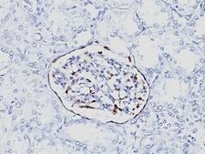 WT1 / Wilms Tumor 1 Antibody - Formalin-fixed, paraffin-embedded human fetal kidney stained with Wilms Tumor 1 antibody (6F-H2).  This image was taken for the unmodified form of this product. Other forms have not been tested.