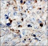 WT1 / Wilms Tumor 1 Antibody - Detection of WT1 in 293 cell lysate.  This image was taken for the unconjugated form of this product. Other forms have not been tested.