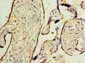 WT1 / Wilms Tumor 1 Antibody - Immunohistochemistry of paraffin-embedded human placenta tissue using antibody at 1:100 dilution.  This image was taken for the unconjugated form of this product. Other forms have not been tested.