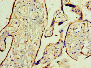 WT1 / Wilms Tumor 1 Antibody - Immunohistochemistry of paraffin-embedded human placenta tissue at dilution 1:100