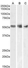 WT1 / Wilms Tumor 1 Antibody - Goat Anti-Wilms tumor 1 / WT1 Antibody (1µg/ml) staining of Human Spleen (A), Kidney (B) and Testis (C) lysates (35µg protein in RIPA buffer). Primary incubation was 1 hour. Detected by chemiluminescencence.