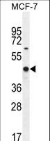 WT1 / Wilms Tumor 1 Antibody - WT1 Antibody (Center E361) western blot of MCF-7 cell line lysates (35 ug/lane). The WT1 antibody detected the WT1 protein (arrow).