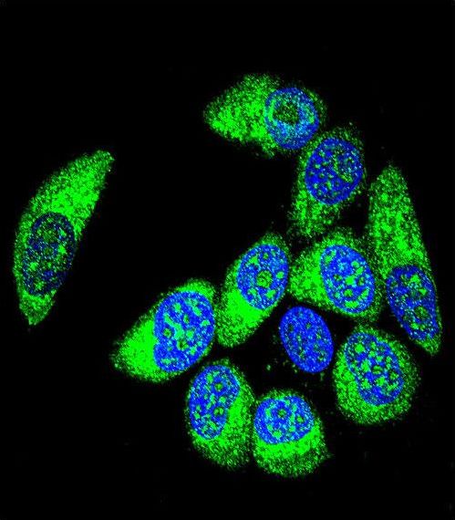 WT1 / Wilms Tumor 1 Antibody - Confocal immunofluorescence of WT1 Antibody (Center E361)with MCF-7 cell followed by Alexa Fluor 488-conjugated goat anti-rabbit lgG (green). DAPI was used to stain the cell nuclear (blue).