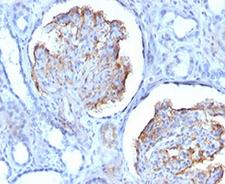WT1 / Wilms Tumor 1 Antibody - IHC testing of formalin-fixed, paraffin-embedded human kidney stained with WT1 antibody (clone RMWT1-1).