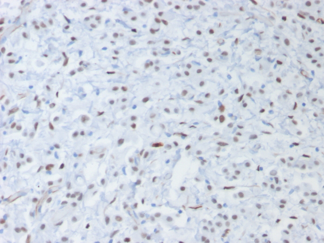 WT1 / Wilms Tumor 1 Antibody - Formalin-fixed, paraffin-embedded Human Testis stained with Wilm’s Tumor Mouse Recombinant Monoclonal Antibody (rWT1/857).