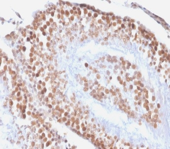 WT1 / Wilms Tumor 1 Antibody - Formalin-fixed, paraffin-embedded Rat Kidney stained with Wilm’s Tumor Mouse Recombinant Monoclonal Antibody (rWT1/857).