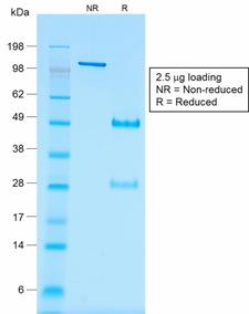 WT1 / Wilms Tumor 1 Antibody - SDS-PAGE Analysis of Purified Wilm’s Tumor Mouse Recombinant Monoclonal Antibody (rWT1/857). Confirmation of Purity and Integrity of Antibody.