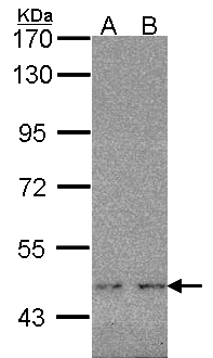 WT1 / Wilms Tumor 1 Antibody - Sample (30 ug of whole cell lysate). A: Molt-4. B: Raji. 10% SDS PAGE. WT1 antibody diluted at 1:1000. 