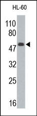 WT1 / Wilms Tumor 1 Antibody - The WT1 Antibody is used in Western blot to detect WT1 in HL-60 cell lysate.
