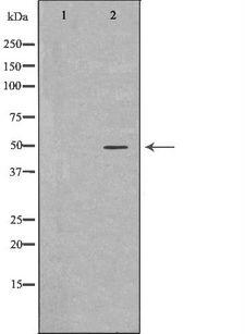 WT1 / Wilms Tumor 1 Antibody - Western blot analysis of kidney lysate using WT1 antibody. The lane on the left is treated with the antigen-specific peptide.