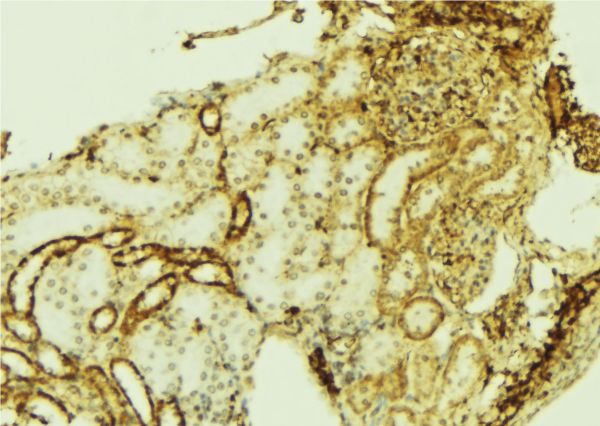 WT1 / Wilms Tumor 1 Antibody - 1:100 staining mouse kidney tissue by IHC-P. The sample was formaldehyde fixed and a heat mediated antigen retrieval step in citrate buffer was performed. The sample was then blocked and incubated with the antibody for 1.5 hours at 22°C. An HRP conjugated goat anti-rabbit antibody was used as the secondary.